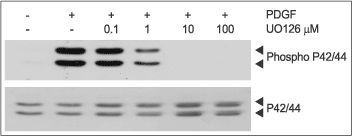 U0126
