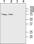 ZIP8/SLC39A8 (extracellular) Blocking Peptide