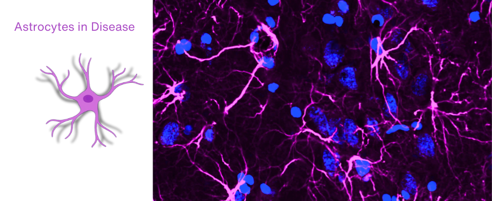 Astrocytes can Drive or Restrain Pathology Depending on the Receptor They Engage