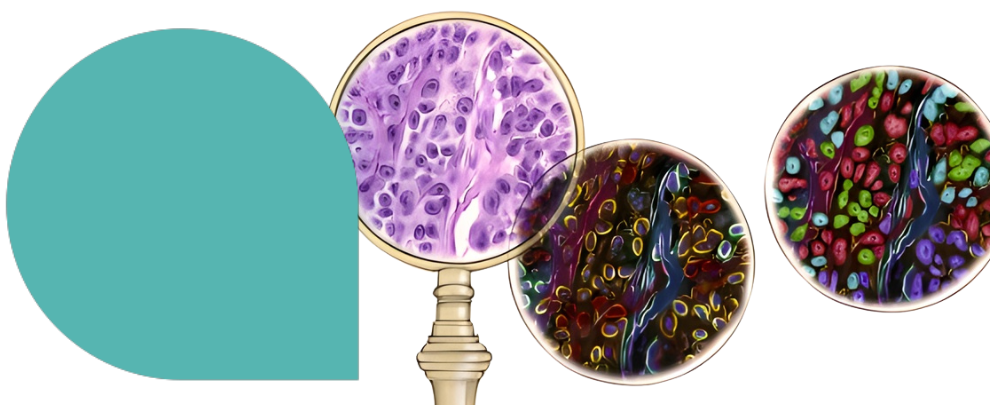 Spatial Proteomics Needs Spatial Thinking