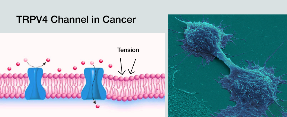 TRPV4 Converts Physical Stress Into Cancer Behavior&hellip;but Only in a Specific Context