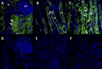 Anti-Angiotensin-(1-7) Mas Receptor Antibody