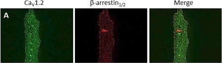 Anti-Cav1.2 (CACNA1C) Antibody