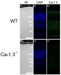 Anti-CaV1.3 (CACNA1D) Antibody