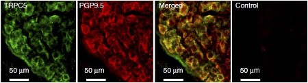 Anti-TRPC5 Antibody