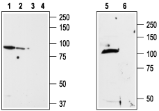 Western blot analysis of ND7/23 cell line membrane (lanes 1 and 3), RBL lysates (lanes 2 and 4) and rat brain membrane (lanes 5and 6):