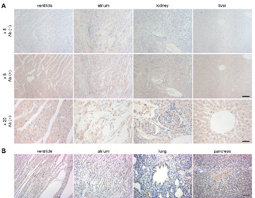 Anti-TRPM4 Antibody