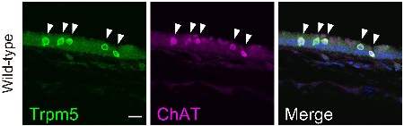 Anti-TRPM5 Antibody