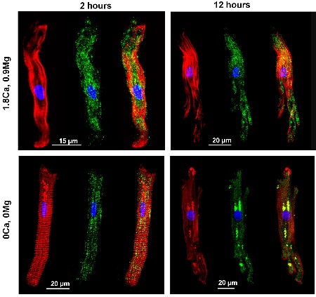 Anti-TRPM7 Antibody