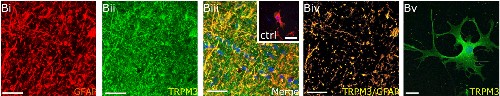 Anti-TRPM3 (extracellular) Antibody