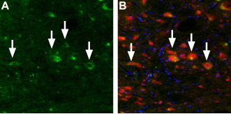 Expression of Mucolipin 3 in mouse brain stem