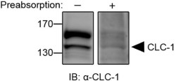 Anti-CLC-1 (CLCN1) Antibody