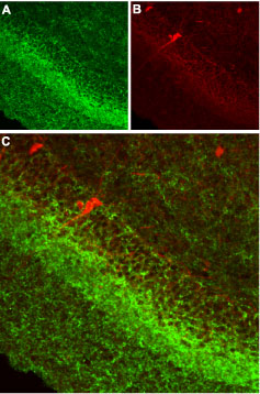 Expression of CB1 receptor in rat hippocampus