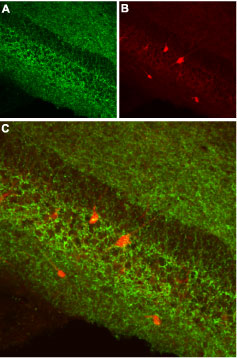 Expression of CB1 receptor in mouse hippocampus