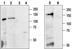 Western blot analysis of Colo205 (lanes 1 and 3), rat liver (lanes 2 and 4) and mouse kidney (lanes 5 and 6) lysates: