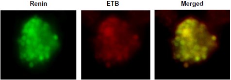Anti-Endothelin Receptor B Antibody