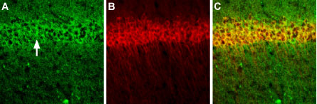 Multiplex staining of NMDAR1 and CALHM1 in mouse hippocampal CA1 region