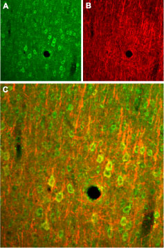 Expression of NMDA receptor 2B in rat cortex