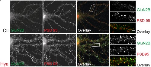 Expression of GluN2B in rat hippocampal neurons