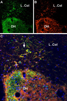 Multiplex staining of VGLUT2 and P2X7 Receptor in rat spinal cord