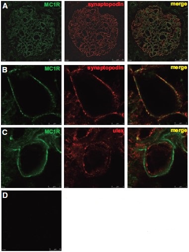 Anti-MC1 Receptor Antibody