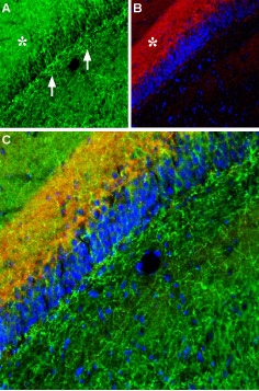 Expression of Noradrenaline transporter (NET) in rat hippocampal dentate gyrus