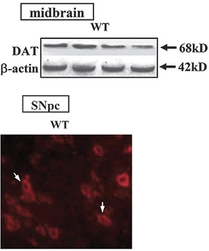 Anti-Dopamine Transporter (DAT) (extracellular) Antibody