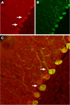 Expression of Nogo receptor in rat cerebellum