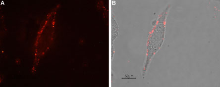 Expression of µ-opioid receptor (MOR-1) in rat C6 cells