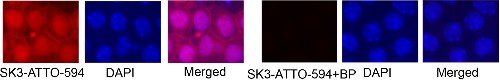 Anti-KCNN3 (KCa2.3, SK3) (N-term)-ATTO Fluor-594 Antibody
