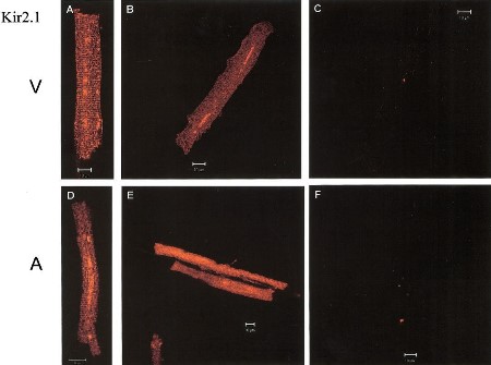 Anti-Kir2.1 (KCNJ2) Antibody