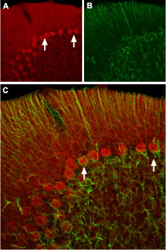 Expression of HCN2 in rat cerebellum