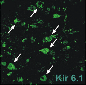 Anti-Kir6.1 (KCNJ8) Antibody