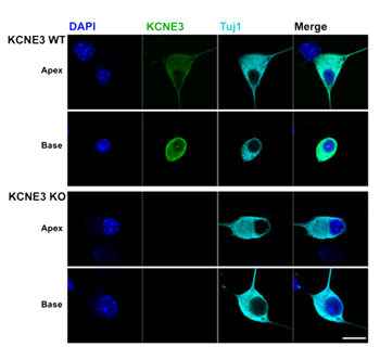 Anti-KCNE3 (MiRP2) Antibody
