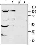 Western blot analysis of rat brain (lanes 1 and 3) and dorsal root ganglion (lanes 2 and 4) membranes: