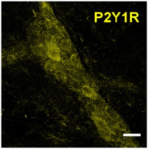 Anti-P2Y1 Receptor Antibody