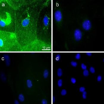 Anti-Aquaporin 5 Antibody