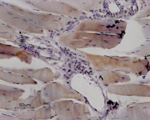 Expression of RyR1 in rat skeletal muscle