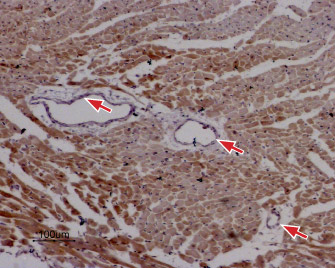 Expression of RyR2 in rat cardiac muscle