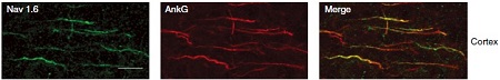 Expression of NaV1.6 in mouse brain