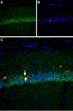Expression of NaV1.6 in mouse hippocampus