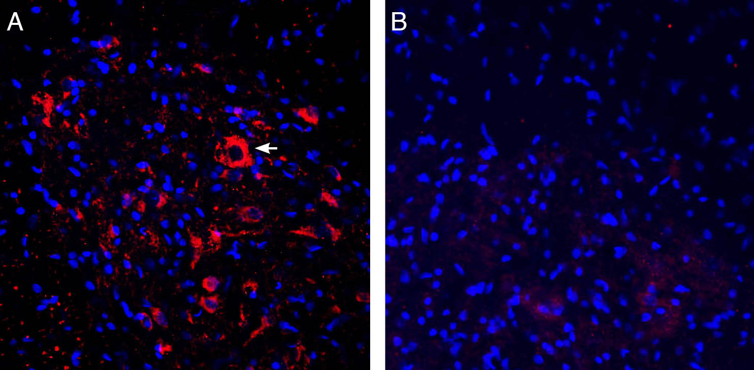 Expression of ASIC2a in rat spinal cord. 