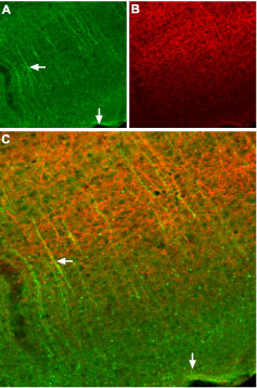 Expression of SSTR2 in mouse cortex