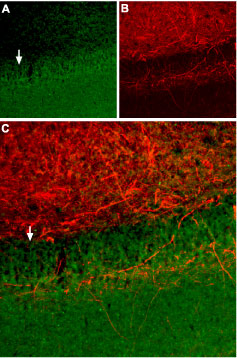 Expression of SSTR2 in rat hippocampus