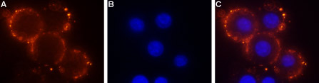 Expression of Sphingosine 1-phosphate receptor 1 in mouse 3T3 cells