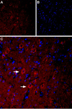 Expression of Serotonin receptor 3A in rat brain