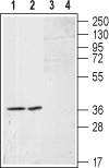 Western blot analysis of (RAEC) rat aortic endothelial  cell line lysates (lanes 1 and 3) and A-10 Rat thoracic aorta smooth muscle (lane 2 and 4) cell lysates: