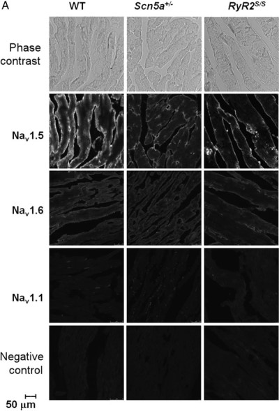 Anti-Nav1.5 (SCN5A) (493-511) Antibody