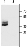 Western blot analysis of mouse brain membranes: