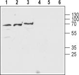 Western blot analysis of SH-SY5Y human neuroblastoma cell lysate (lanes 1 and 4) and rat (lanes 2 and 5) and mouse (lanes 3 and 6) brain lysate: